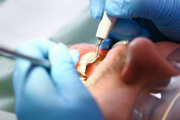 Best Dentist for Tooth Abscess  in Tiltonsville, OH